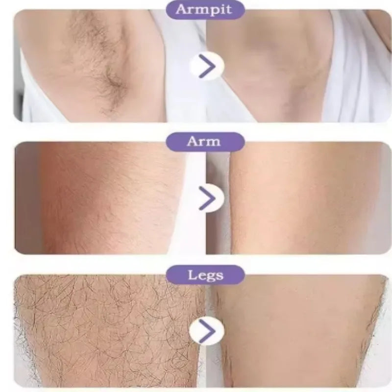 Removedor de Pelos de Cristal Portátil Reutilizável Depilador Indolor para Corpo e Pernas